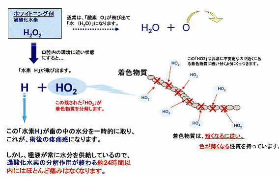 ホワイトニングで歯が白くなるメカニズム